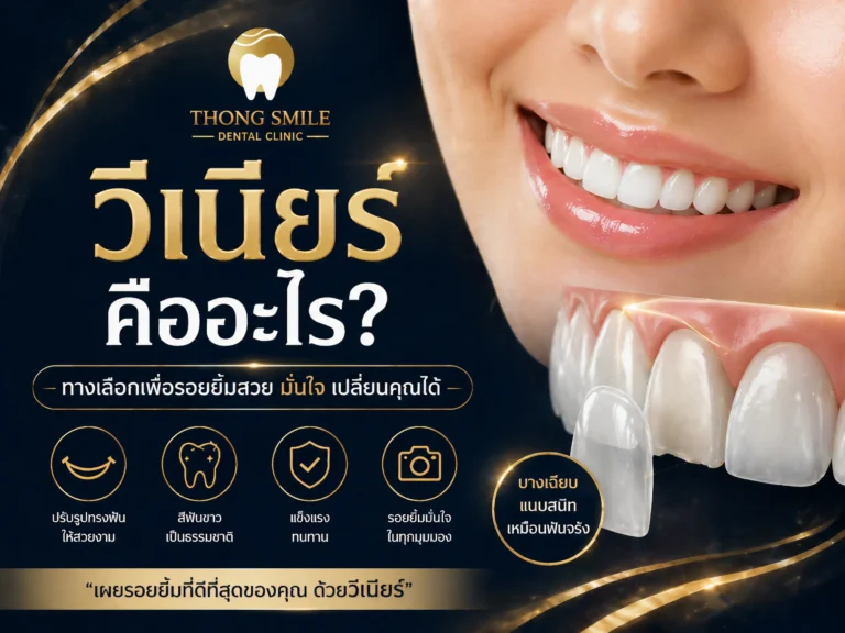 วีเนียร์คืออะไร-cover