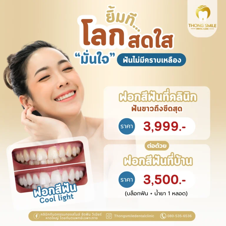 20260429 ฟอกสีฟันที่คลินิก ยิ้มโลกสดใส