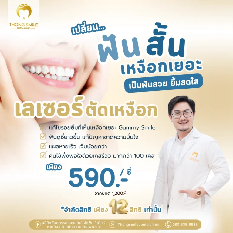 20260429 เลเซอร์ตัดเหงือก