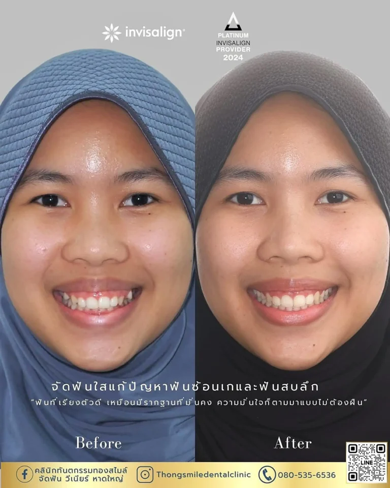 dental care 260929 1