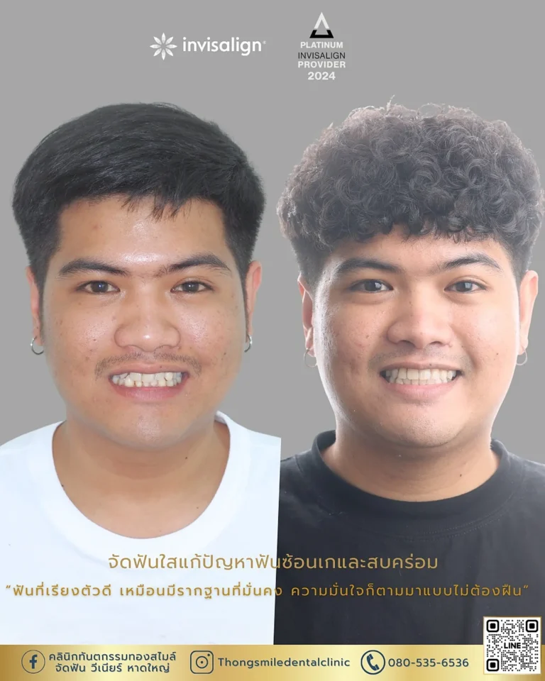 dental care 260929 2