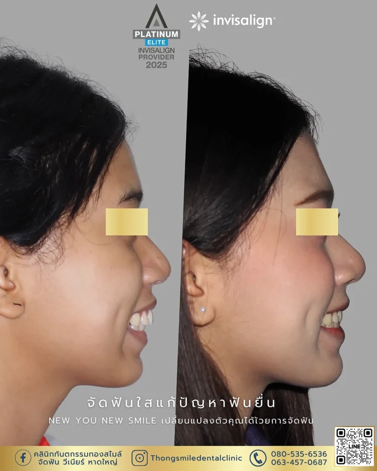 dental care 260929 3