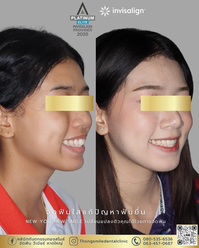 dental care 260929 4