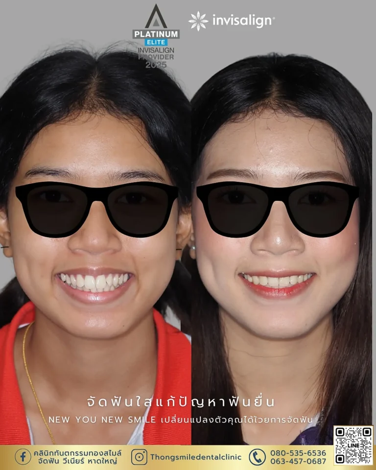 dental care 260929 5