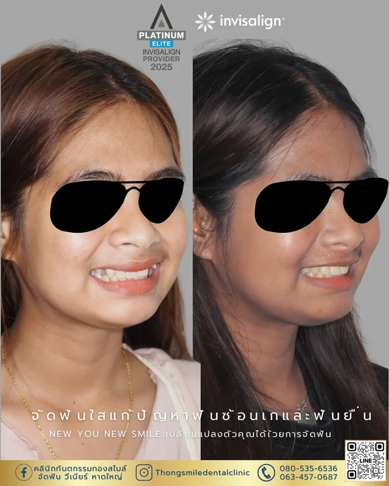 dental care 260929 6