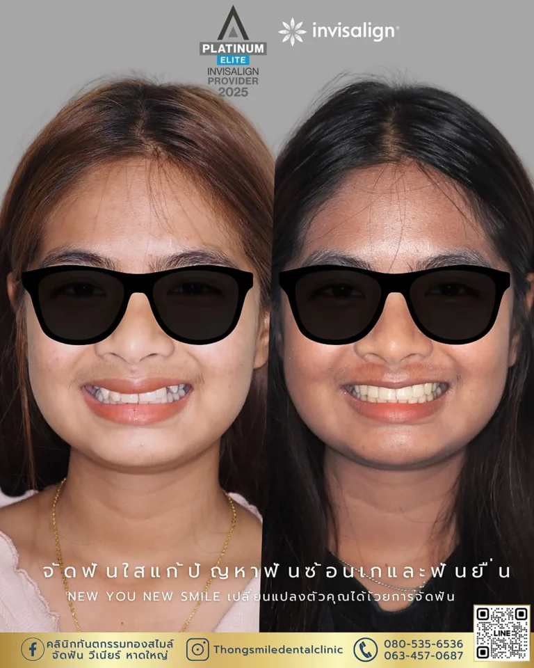 dental care 260929 7