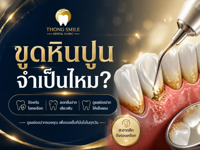 ขูดหินปูนจำเป็นไหม-cover