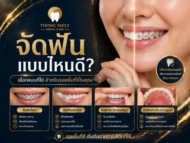 จัดฟันแบบไหนดี-cover