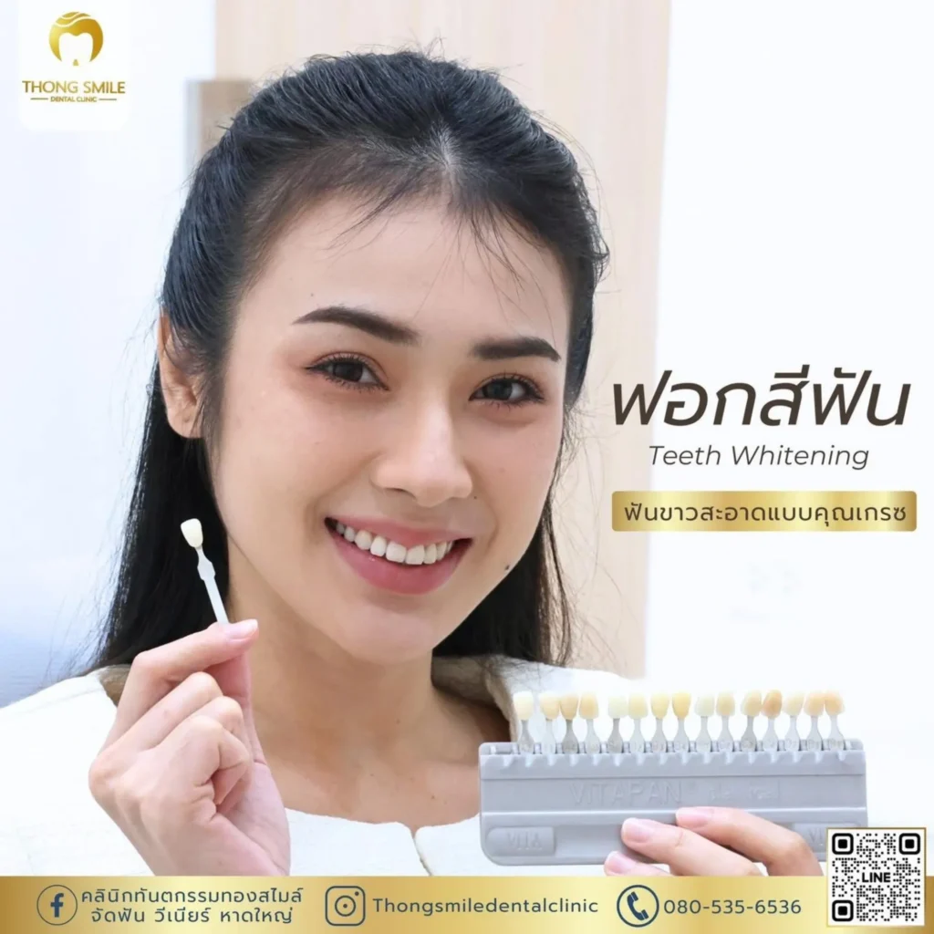 ฟอกสีฟันอันตรายไหม? ข้อควรรู้ก่อนตัดสินใจ 4 ฟอกสีฟันอันตรายไหม? ข้อควรรู้ก่อนตัดสินใจ