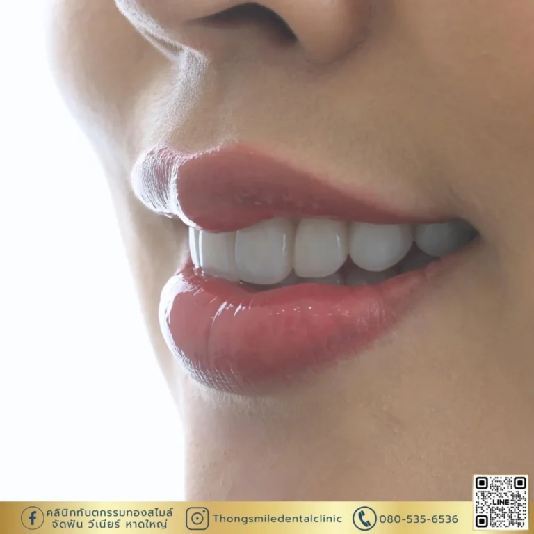 หน้าแรก 55 20260508 Case Thong Smile 260508 9 Horizontal