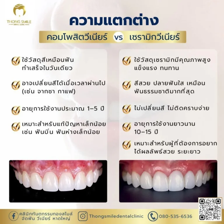 20260508 Thong Smile 1 260508 5 Horizontal