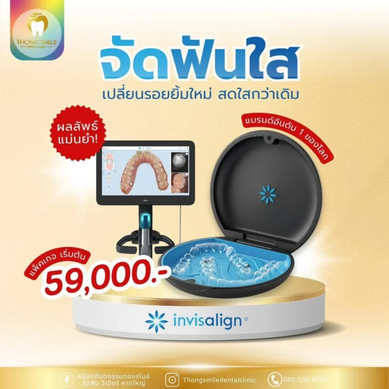 จัดฟัน 2 20260508 Thong Smile _2_260508_8 (Horizontal)